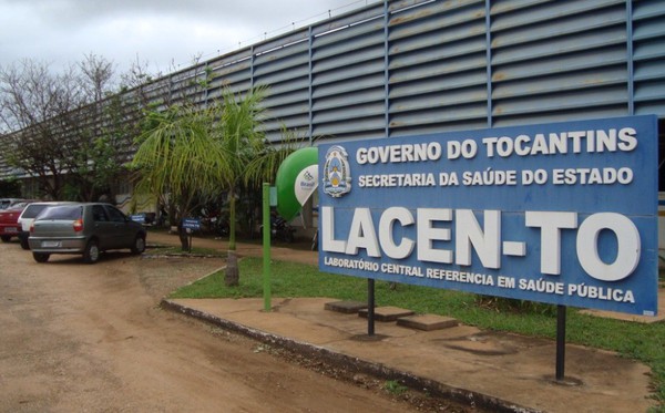 União e o Governo do Tocantins devem comprovar a regularização do abastecimento do estoque de insumos do Lacen-TO