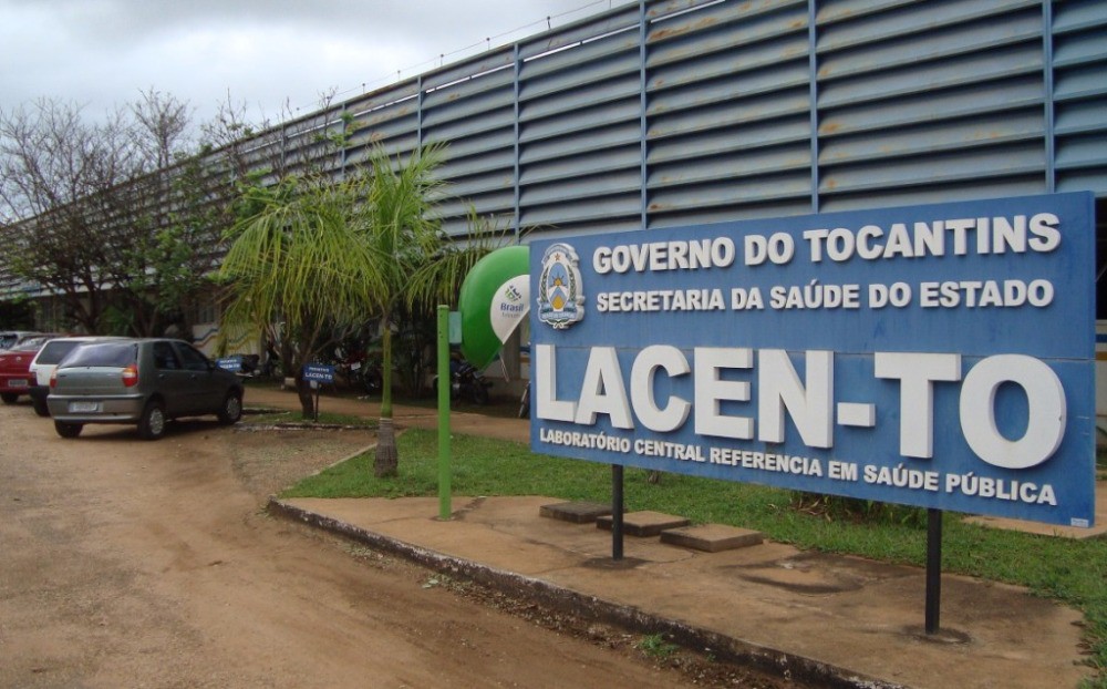 União e o Governo do Tocantins devem comprovar a regularização do abastecimento do estoque de insumos do Lacen-TO.